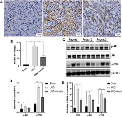 Transcriptome-Based Network Analysis Reveals Hirudin Potentiates Anti-Renal Fibrosis Efficacy in UUO Rats